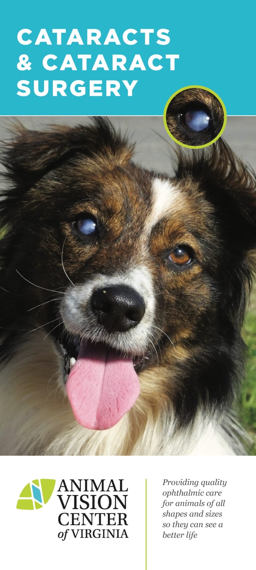 AVCVA Cataracts and Cataract Surgery Brochure