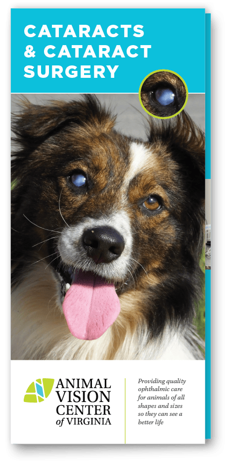 Cataracts Brochure